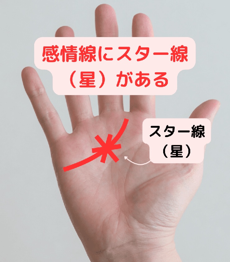 感情線にスター線(星)がある